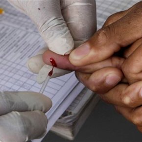 UN: HIV patients should start treatment immediately
