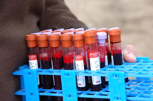 Blood samples are collected from Yellowstone National Park bison on Wednesday, March 9, 2016 in Yellowstone National Park, Mont. Many park bison carry the disease brucellosis, prompting the park to capture and kill the animals when they attempt to migrate into Montana to prevent transmissions to livestock. (AP Photo/Matthew Brown)