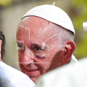 Pope arrival in Cartagena off to bumpy start with black eye